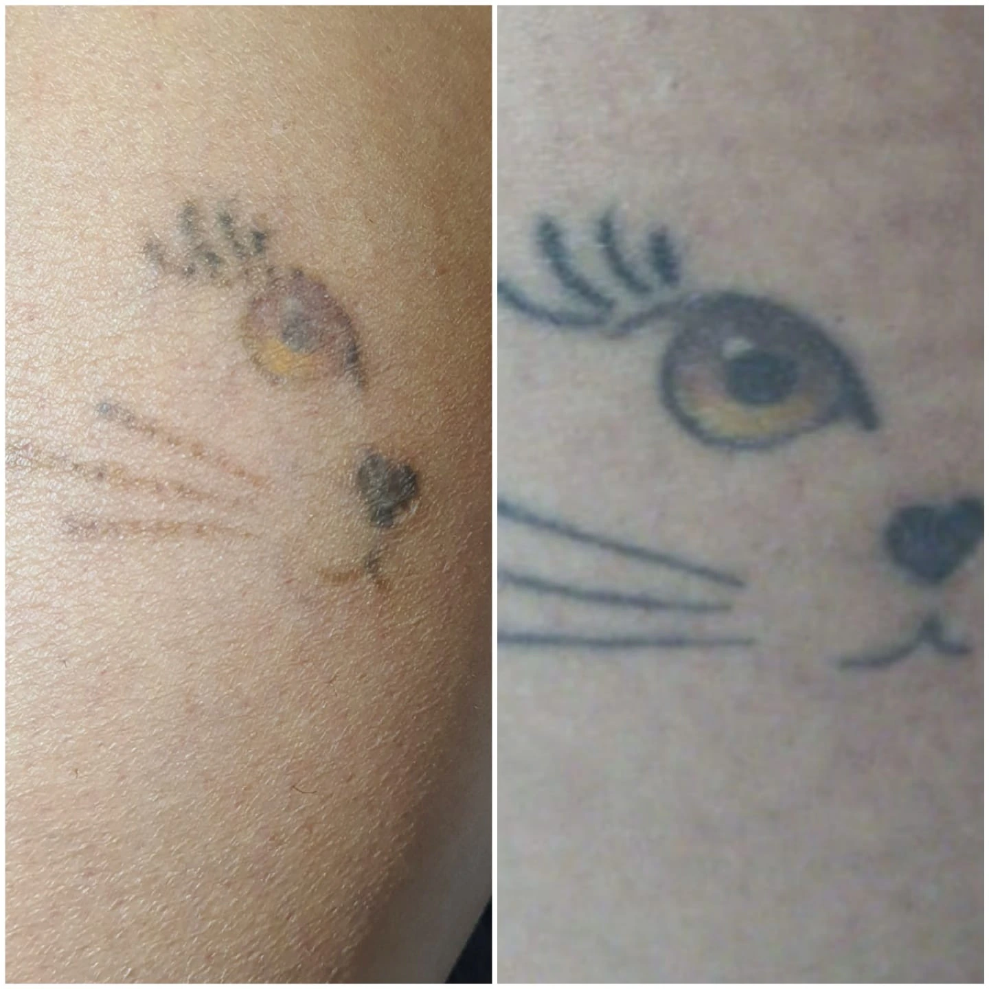 Antes e depois da remoção a laser de tatuagem colorida de gato